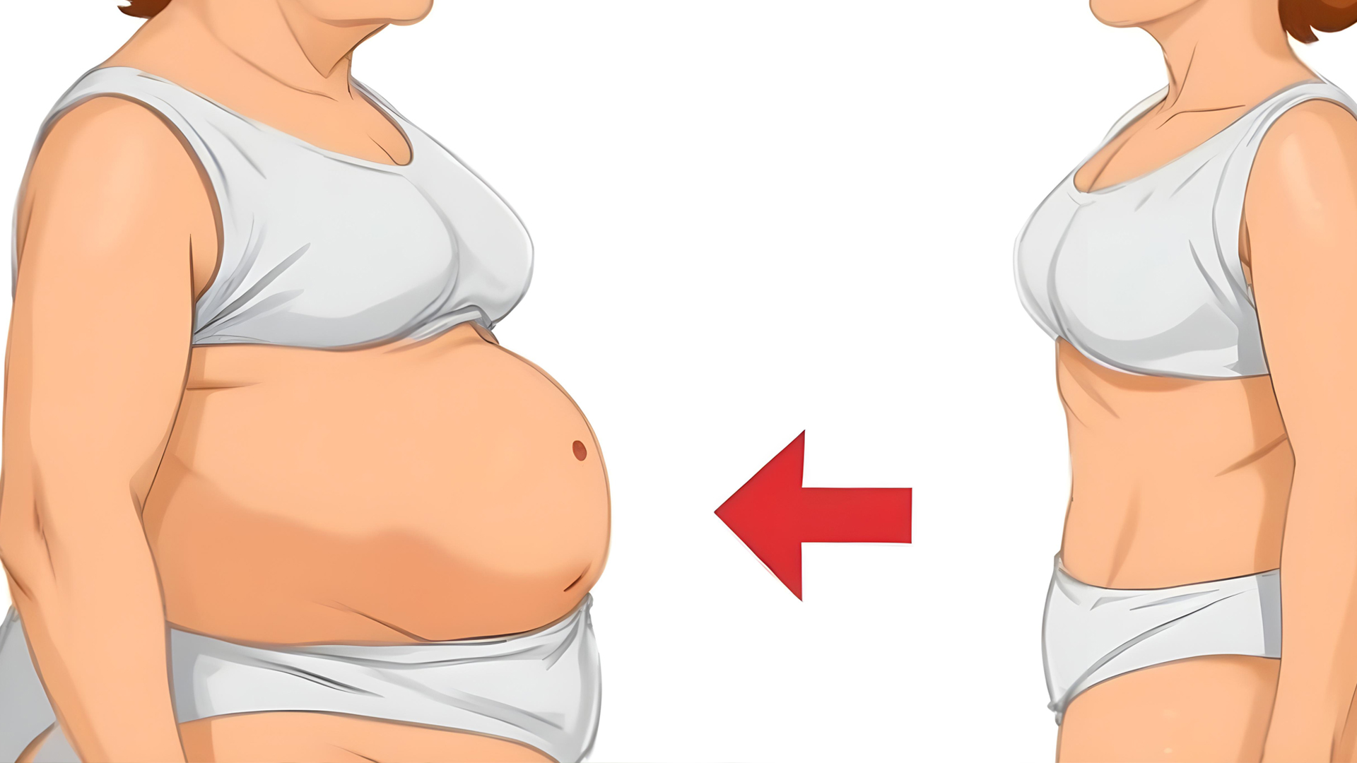 PCOS weight gain