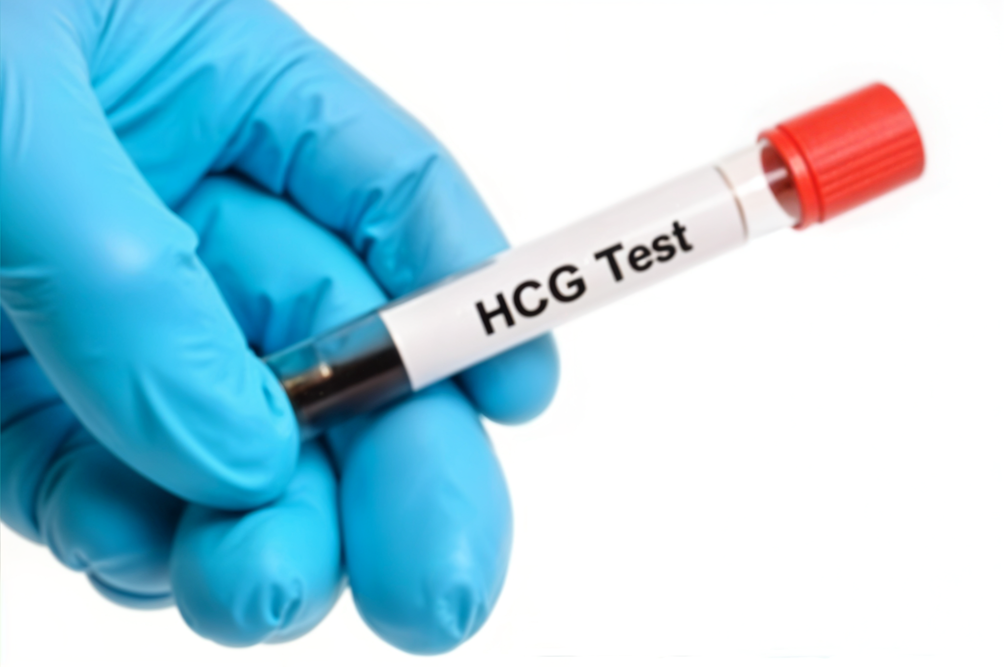 HCG testosterone therapy