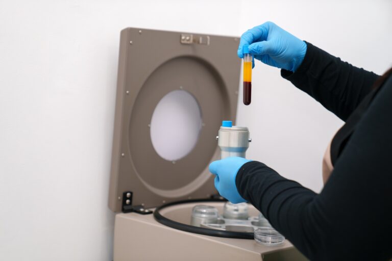 Healthcare Professional Handling Blood Samples for PRP