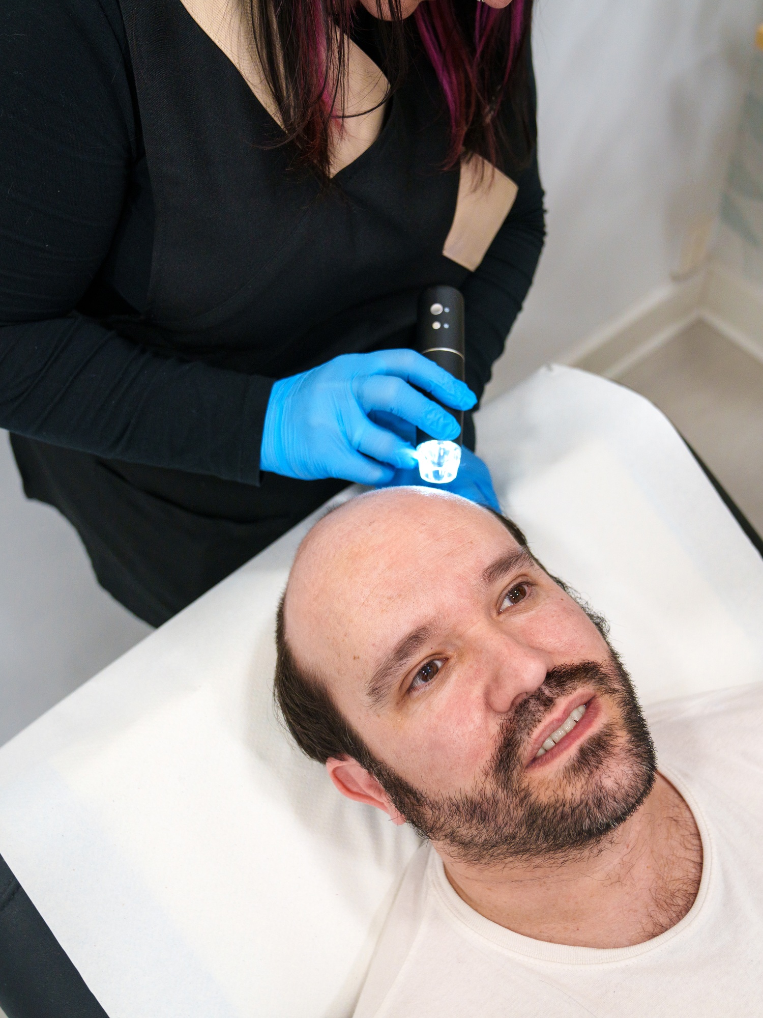 In-depth Scalp Analysis with a Dermascope in Hair Clinic
