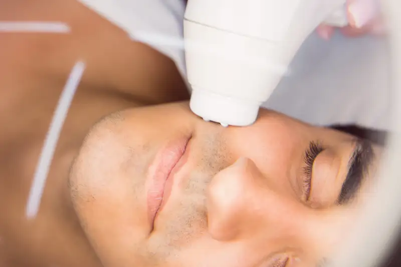 Acne & Acne Scar Revision
