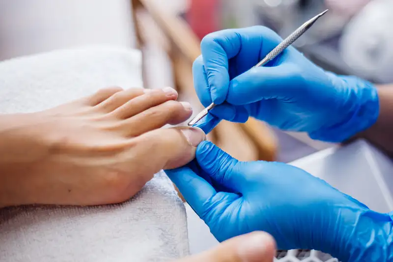 Onychomycosis Treatment