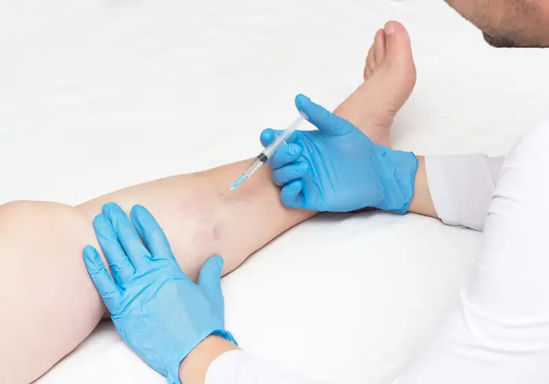 Vascular Lesions