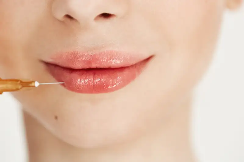 Lip Lase